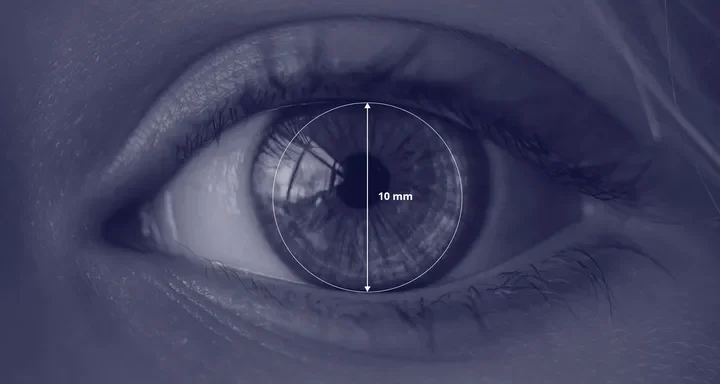 Eye-Openness Eye-Openness